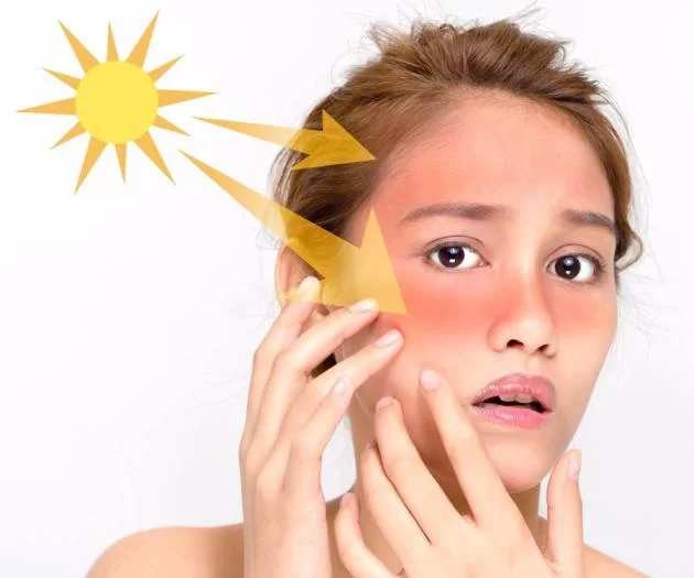  کرم ضد آفتاب چیست و چرا باید از آن استفاده کنیم؟